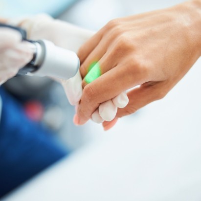 Laser Doigts — 30 min