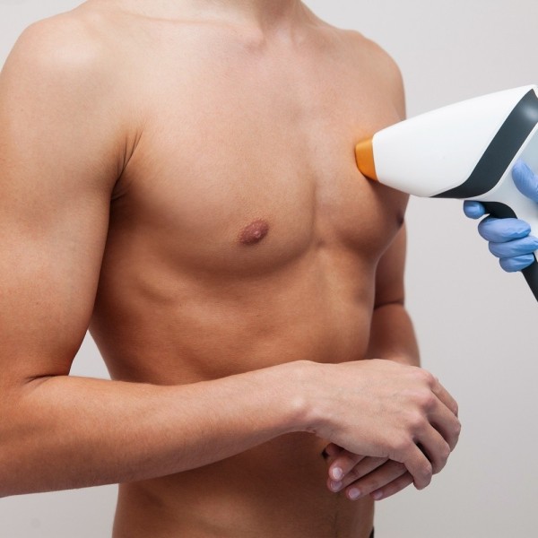 Laser Ventre complet — 30 min