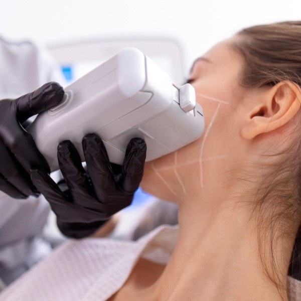 Bilan de peau avec scanner "IA" et devis HIFU visage — 45 min