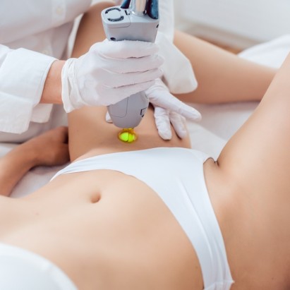 Laser Maillot Intégral — 30 min