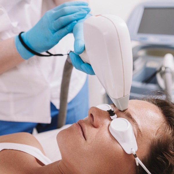 Laser Inter sourcilier — 30 min